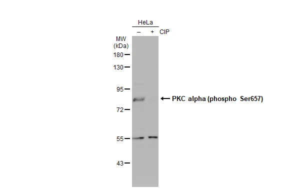 Untreated (–) and treated (+) HeLa whole cell extracts (30 μg) were separated by 7.5% SDS-PAGE, and the membrane was blotted with PKC alpha (phospho Ser657) antibody (GTX133936) diluted at 1:500. The HRP-conjugated anti-rabbit IgG antibody (GTX213110-01) was used to detect the primary antibody, and the signal was developed with Trident ECL plus-Enhanced.