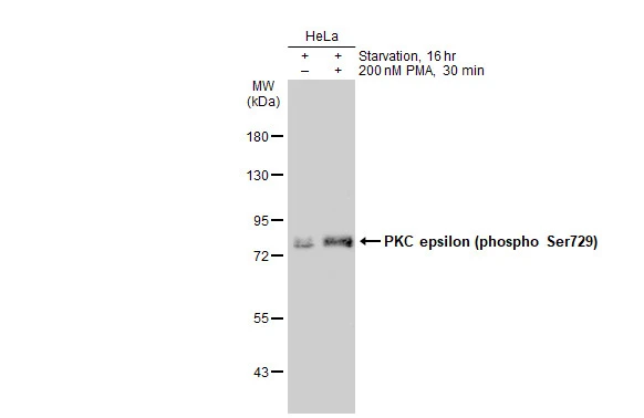 Untreated (–) and treated (+) HeLa whole cell extracts (30 μg) were separated by 7.5% SDS-PAGE, and the membrane was blotted with PKC epsilon (phospho Ser729) antibody (GTX133937) diluted at 1:10000. The HRP-conjugated anti-rabbit IgG antibody (GTX213110-01) was used to detect the primary antibody.