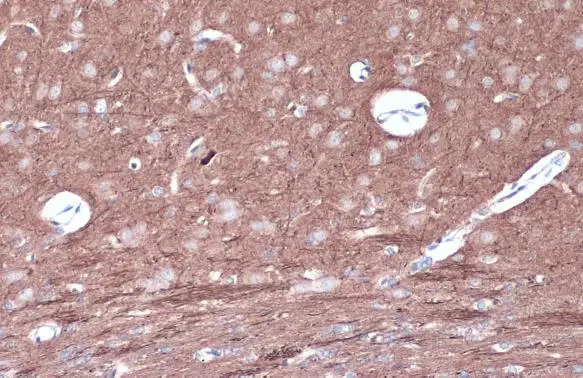 PKC epsilon (phospho Ser729) antibody detects PKC epsilon (phospho Ser729) protein at cell membrane and cytoplasm by immunohistochemical analysis. Sample: Paraffin-embedded mouse brain. PKC epsilon (phospho Ser729) stained by PKC epsilon (phospho Ser729) antibody (GTX133937) diluted at 1:500. Antigen Retrieval: Citrate buffer, pH 6.0, 15 min