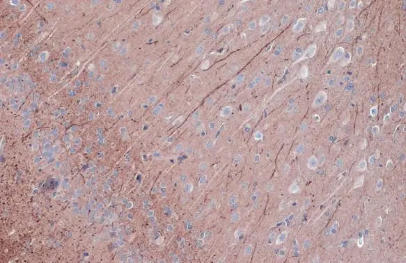 PKC epsilon (phospho Ser729) antibody detects PKC epsilon (phospho Ser729) protein at cell membrane and cytoplasm by immunohistochemical analysis. Sample: Paraffin-embedded rat brain. PKC epsilon (phospho Ser729) stained by PKC epsilon (phospho Ser729) antibody (GTX133937) diluted at 1:500. Antigen Retrieval: Citrate buffer, pH 6.0, 15 min
