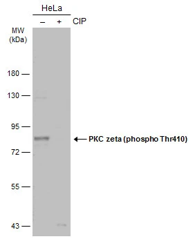 Untreated (–) and treated (+) HeLa whole cell extracts (30 μg) were separated by 7.5% SDS-PAGE, and the membrane was blotted with PKC zeta (phospho Thr410) antibody (GTX133939) diluted at 1:500. The HRP-conjugated anti-rabbit IgG antibody (GTX213110-01) was used to detect the primary antibody. Untreated (–) and treated (+) HeLa whole cell extracts (30 μg) were separated by 7.5% SDS-PAGE, and the membrane was blotted with PKC zeta (phospho Thr410) antibody (GTX133939) diluted at 1:500. The HRP-conjugated anti-rabbit IgG antibody (GTX213110-01) was used to detect the primary antibody.