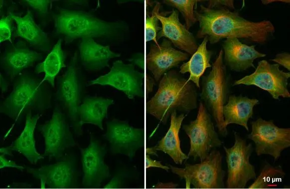 PKC zeta (phospho Thr410) antibody detects PKC zeta (phospho Thr410) protein at cytoplasm and nucleus by immunofluorescent analysis. Sample: HeLa cells were fixed in 4% paraformaldehyde at RT for 15 min. Green: PKC zeta (phospho Thr410) stained by PKC zeta (phospho Thr410) antibody (GTX133939) diluted at 1:500. Red: alpha Tubulin, a cytoskeleton marker, stained by alpha Tubulin antibody [GT114] (GTX628802) diluted at 1:1000. Blue: Fluoroshield with DAPI (GTX30920).