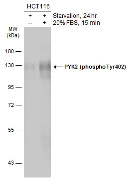 Untreated (–) and treated (+) HCT116 whole cell extracts (30 μg) were separated by 7.5% SDS-PAGE, and the membrane was blotted with PYK2 (phospho Tyr402) antibody (GTX133940) diluted at 1:500. The HRP-conjugated anti-rabbit IgG antibody (GTX213110-01) was used to detect the primary antibody.