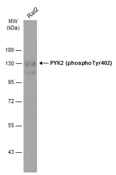 Whole cell extract (30 μg) was separated by 7.5% SDS-PAGE, and the membrane was blotted with PYK2 (phospho Tyr402) antibody (GTX133940) diluted at 1:500. The HRP-conjugated anti-rabbit IgG antibody (GTX213110-01) was used to detect the primary antibody.