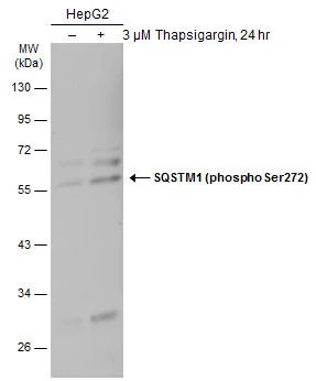 Untreated (–) and treated (+) HepG2 whole cell extracts (30 μg) were separated by 10% SDS-PAGE, and the membrane was blotted with SQSTM1 (phospho Ser272) antibody (GTX133943) diluted at 1:500. The HRP-conjugated anti-rabbit IgG antibody (GTX213110-01) was used to detect the primary antibody, and the signal was developed with Trident ECL plus-Enhanced.