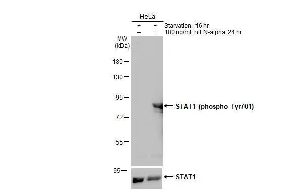 Untreated (–) and treated (+) HeLa whole cell extract (30 μg) were separated by 7.5% SDS-PAGE, and the membrane was blotted with STAT1 (phospho Tyr701) antibody (GTX133944) diluted at 1:1000. The HRP-conjugated anti-rabbit IgG antibody (GTX213110-01) was used to detect the primary antibody, and the signal was developed with Trident ECL plus-Enhanced.
