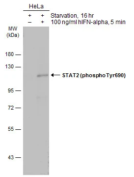 Untreated (–) and treated (+) HeLa whole cell extracts (30 μg) were separated by 7.5% SDS-PAGE, and the membrane was blotted with STAT2 (phospho Tyr690) antibody (GTX133945) diluted at 1:500. The HRP-conjugated anti-rabbit IgG antibody (GTX213110-01) was used to detect the primary antibody.