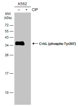 Untreated (–) and treated (+) K562 whole cell extracts (30 μg) were separated by 12% SDS-PAGE, and the membrane was blotted with CrkL (phospho Tyr207) antibody (GTX133949) diluted at 1:1000. The HRP-conjugated anti-rabbit IgG antibody (GTX213110-01) was used to detect the primary antibody.