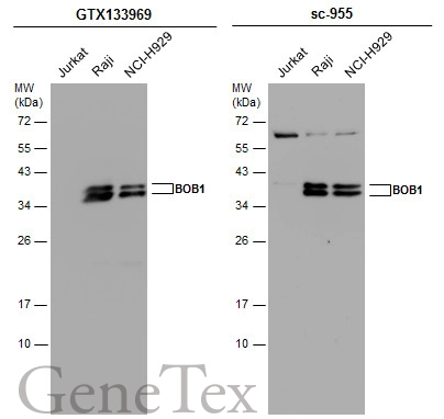Various whole cell extracts (30 μg) were separated by 12% SDS-PAGE, and the membranes were blotted with BOB1 antibody (GTX133969) diluted at 1:1000 and competitor's antibody (sc-955) diluted at 1:1000. The HRP-conjugated anti-rabbit IgG antibody (GTX213110-01) was used to detect the primary antibody.
