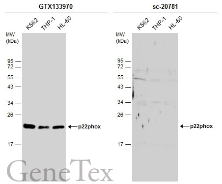 Various whole cell extracts (30 μg) were separated by 12% SDS-PAGE, and the membranes were blotted with p22phox antibody (GTX133970) diluted at 1:1000 and competitor's antibody (sc-20781) diluted at 1:100. The HRP-conjugated anti-rabbit IgG antibody (GTX213110-01) was used to detect the primary antibody. Santa Cruz Biotechnology is not affiliated with GeneTex and does not endorse this product.