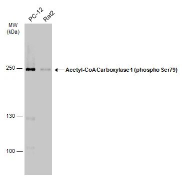 Various whole cell extracts (30 μg) were separated by 5% SDS-PAGE, and the membrane was blotted with Acetyl-CoA Carboxylase 1 (phospho Ser79) antibody (GTX133974) diluted at 1:500. The HRP-conjugated anti-rabbit IgG antibody (GTX213110-01) was used to detect the primary antibody.