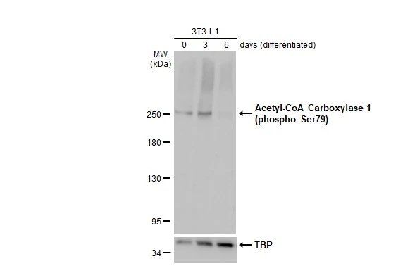 Various whole cell extracts (30 μg) were separated by 5% SDS-PAGE, and the membrane was blotted with Acetyl-CoA Carboxylase 1 (phospho Ser79) antibody (GTX133974) diluted at 1:500. The HRP-conjugated anti-rabbit IgG antibody (GTX213110-01) was used to detect the primary antibody.