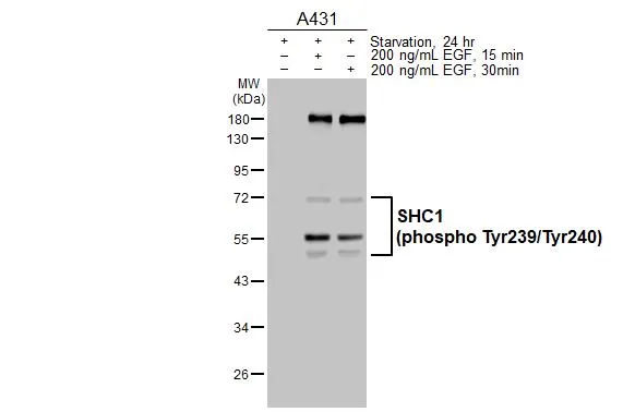 Untreated (–) and treated (+) A431 whole cell extracts (30 μg) were separated by 10% SDS-PAGE, and the membrane was blotted with SHC1 (phospho Tyr239/240) antibody (GTX133985) diluted at 1:1000. The HRP-conjugated anti-rabbit IgG antibody (GTX213110-01) was used to detect the primary antibody.