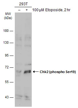 Untreated (–) and treated (+) 293T whole cell extracts (30 μg) were separated by 7.5% SDS-PAGE, and the membrane was blotted with Chk2 (phospho Ser19) antibody (GTX133989) diluted at 1:500. The HRP-conjugated anti-rabbit IgG antibody (GTX213110-01) was used to detect the primary antibody.