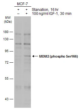 Untreated (–) and treated (+) MCF-7 whole cell extracts (30 μg) were separated by 10% SDS-PAGE, and the membrane was blotted with MDM2 (phospho Ser166) antibody (GTX133996) diluted at 1:500. The HRP-conjugated anti-rabbit IgG antibody (GTX213110-01) was used to detect the primary antibody, and the signal was developed with Trident ECL plus-Enhanced.