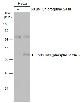 Untreated (–) and treated (+) HeLa whole cell extracts (30 μg) were separated by 10% SDS-PAGE, and the membrane was blotted with SQSTM1 (phospho Ser349) antibody (GTX134001) diluted at 1:500. The HRP-conjugated anti-rabbit IgG antibody (GTX213110-01) was used to detect the primary antibody, and the signal was developed with Trident ECL plus-Enhanced.
