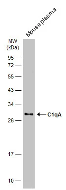 Mouse plasma (50 μg) was separated by 12% SDS-PAGE, and the membrane was blotted with C1qA antibody (GTX134007) diluted at 1:1000. The HRP-conjugated anti-rabbit IgG antibody (GTX213110-01) was used to detect the primary antibody. Mouse plasma (50 μg) was separated by 12% SDS-PAGE, and the membrane was blotted with C1qA antibody (GTX134007) diluted at 1:1000. The HRP-conjugated anti-rabbit IgG antibody (GTX213110-01) was used to detect the primary antibody.