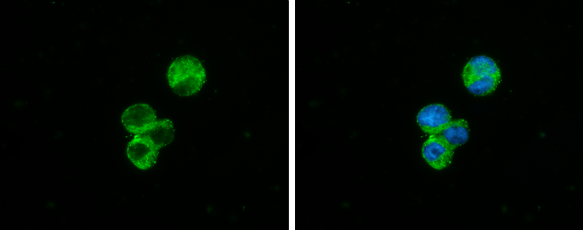 C1qA antibody detects C1qA protein at cytoplasm by immunofluorescent analysis. Sample: THP-1 cells were fixed in 4% paraformaldehyde at RT for 15 min. Green: C1qA stained by C1qA antibody (GTX134007) diluted at 1:500. Blue: Fluoroshield with DAPI (GTX30920). C1qA antibody detects C1qA protein at cytoplasm by immunofluorescent analysis. Sample: THP-1 cells were fixed in 4% paraformaldehyde at RT for 15 min. Green: C1qA stained by C1qA antibody (GTX134007) diluted at 1:500. Blue: Fluoroshield with DAPI (GTX30920).