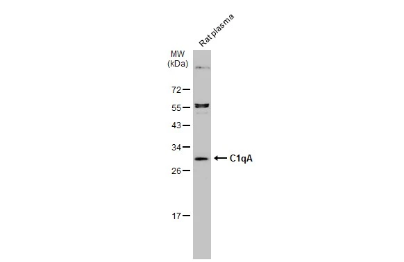 Rat plasma (30 μg) was separated by 12% SDS-PAGE, and the membrane was blotted with C1qA antibody (GTX134007) diluted at 1:1000. The HRP-conjugated anti-rabbit IgG antibody (GTX213110-01) was used to detect the primary antibody. Rat plasma (30 μg) was separated by 12% SDS-PAGE, and the membrane was blotted with C1qA antibody (GTX134007) diluted at 1:1000. The HRP-conjugated anti-rabbit IgG antibody (GTX213110-01) was used to detect the primary antibody.