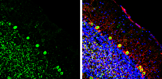 EN1 antibody