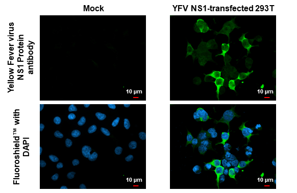 Yellow Fever virus NS1 Protein antibody detects Yellow Fever virus NS1 protein by immunofluorescent analysis. Sample: Mock and transfected 293T cells were fixed in 4% paraformaldehyde at RT for 15 min. Green: Yellow Fever virus NS1 Protein stained by Yellow Fever virus NS1 Protein antibody (GTX134025) diluted at 1:500. Blue: Fluoroshield with DAPI (GTX30920).