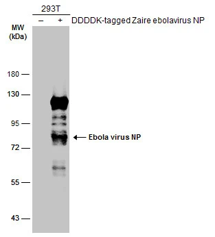 Anti-Ebola virus NP antibody (GTX134031) | GeneTex