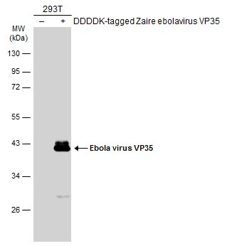 Non-transfected (–) and transfected (+) 293T whole cell extracts (30 μg) were separated by 10% SDS-PAGE, and the membrane was blotted with Ebola virus VP35 antibody (GTX134033) diluted at 1:5000. The HRP-conjugated anti-rabbit IgG antibody (GTX213110-01) was used to detect the primary antibody.