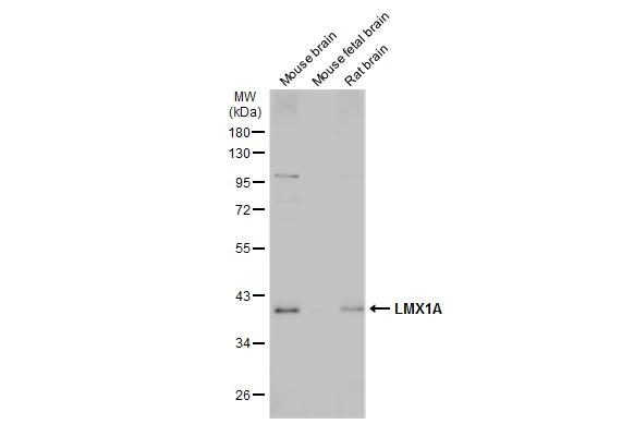 Various tissue extracts (50 μg) were separated by 10% SDS-PAGE, and the membrane was blotted with LMX1A (GTX134047) diluted at 1:1000. The HRP-conjugated anti-rabbit IgG antibody (GTX213110-01) was used to detect the primary antibody.