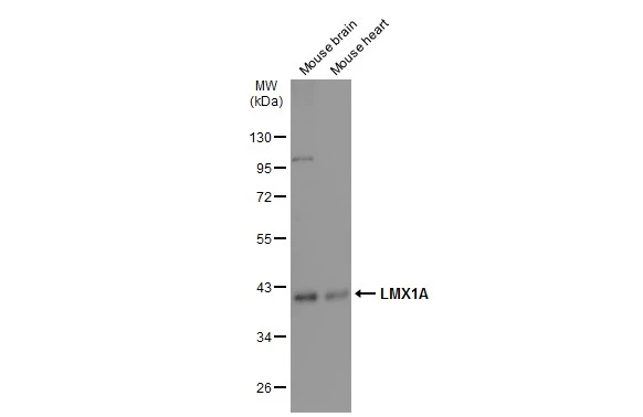 Various tissue extracts (50 μg) were separated by 10% SDS-PAGE, and the membrane was blotted with LMX1A antibody (GTX134047) diluted at 1:1000. The HRP-conjugated anti-rabbit IgG antibody (GTX213110-01) was used to detect the primary antibody.