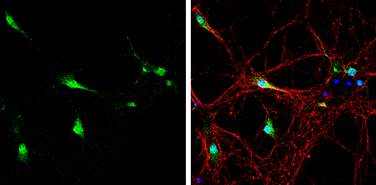Neurogranin antibody detects Neurogranin protein by immunofluorescent analysis. Sample: DIV9 rat E18 primary hippocampal neuron cells were fixed in 4% paraformaldehyde at RT for 15 min. Green: Neurogranin stained by Neurogranin antibody (GTX134048) diluted at 1:500. Red: beta Tubulin 3/ Tuj1, stained by beta Tubulin 3/ Tuj1 antibody [GT11710] (GTX631836) diluted at 1:500. Blue: Fluoroshield with DAPI (GTX30920).