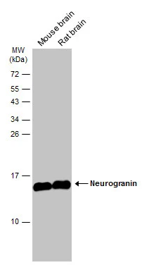 Various tissue extracts (50 μg) were separated by 15% SDS-PAGE, and the membrane was blotted with Neurogranin antibody (GTX134048) diluted at 1:1000. The HRP-conjugated anti-rabbit IgG antibody (GTX213110-01) was used to detect the primary antibody.