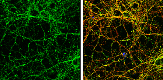 Doublecortin antibody