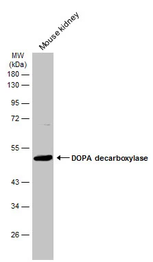 DOPA Decarboxylase antibody