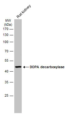 DOPA Decarboxylase antibody