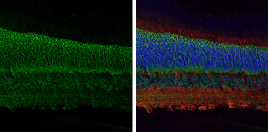 EAAT1 antibody