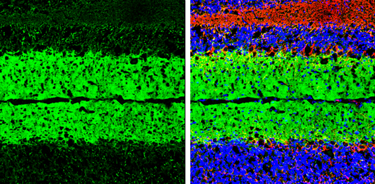 EAAT1 antibody