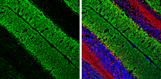Anti-EAAT1 antibody (GTX134060) | GeneTex