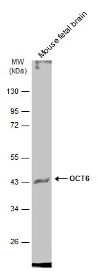 OCT6 antibody