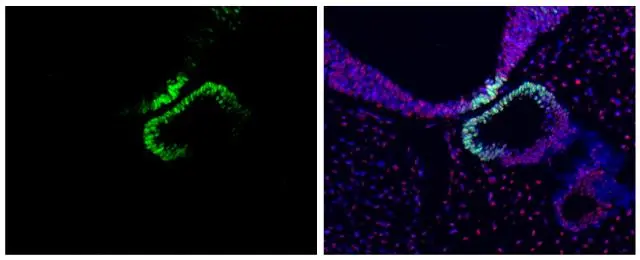 OCT6 antibody