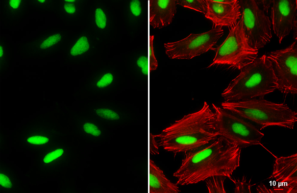 OCT6 antibody