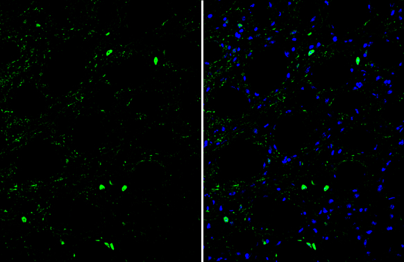 OCT6 antibody