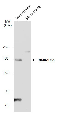 Anti-NMDAR2A antibody (GTX134064) | GeneTex