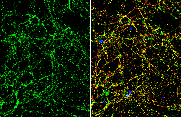 Anti-NMDAR2A antibody (GTX134064) | GeneTex