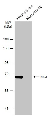 Various tissue extracts (50 μg) were separated by 7.5% SDS-PAGE, and the membrane was blotted with NF-L antibody (GTX134075) diluted at 1:1000. The HRP-conjugated anti-rabbit IgG antibody (GTX213110-01) was used to detect the primary antibody.