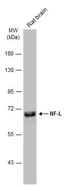 Rat tissue extract (50 μg) was separated by 7.5% SDS-PAGE, and the membrane was blotted with NF-L antibody (GTX134075) diluted at 1:2000. The HRP-conjugated anti-rabbit IgG antibody (GTX213110-01) was used to detect the primary antibody.