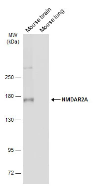 NMDAR2A antibody
