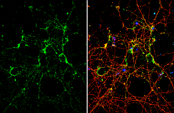 NMDAR2A antibody