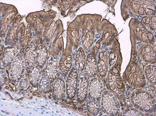 Trefoil Factor 3 antibody detects Trefoil Factor 3 protein at cell membrane and cytoplasm by immunohistochemical analysis. Sample: Paraffin-embedded mouse colon. Trefoil Factor 3 stained by Trefoil Factor 3 antibody (GTX134098) diluted at 1:1500.
 Antigen Retrieval: Citrate buffer, pH 6.0, 15 min