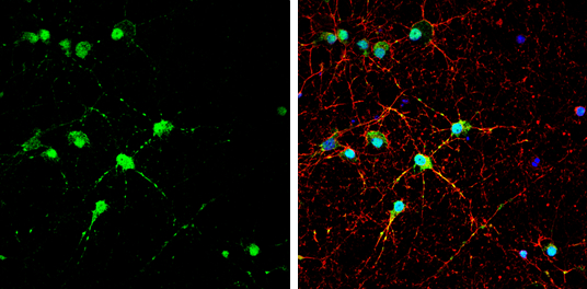 EAAT4 antibody