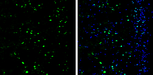 SATB2 antibody